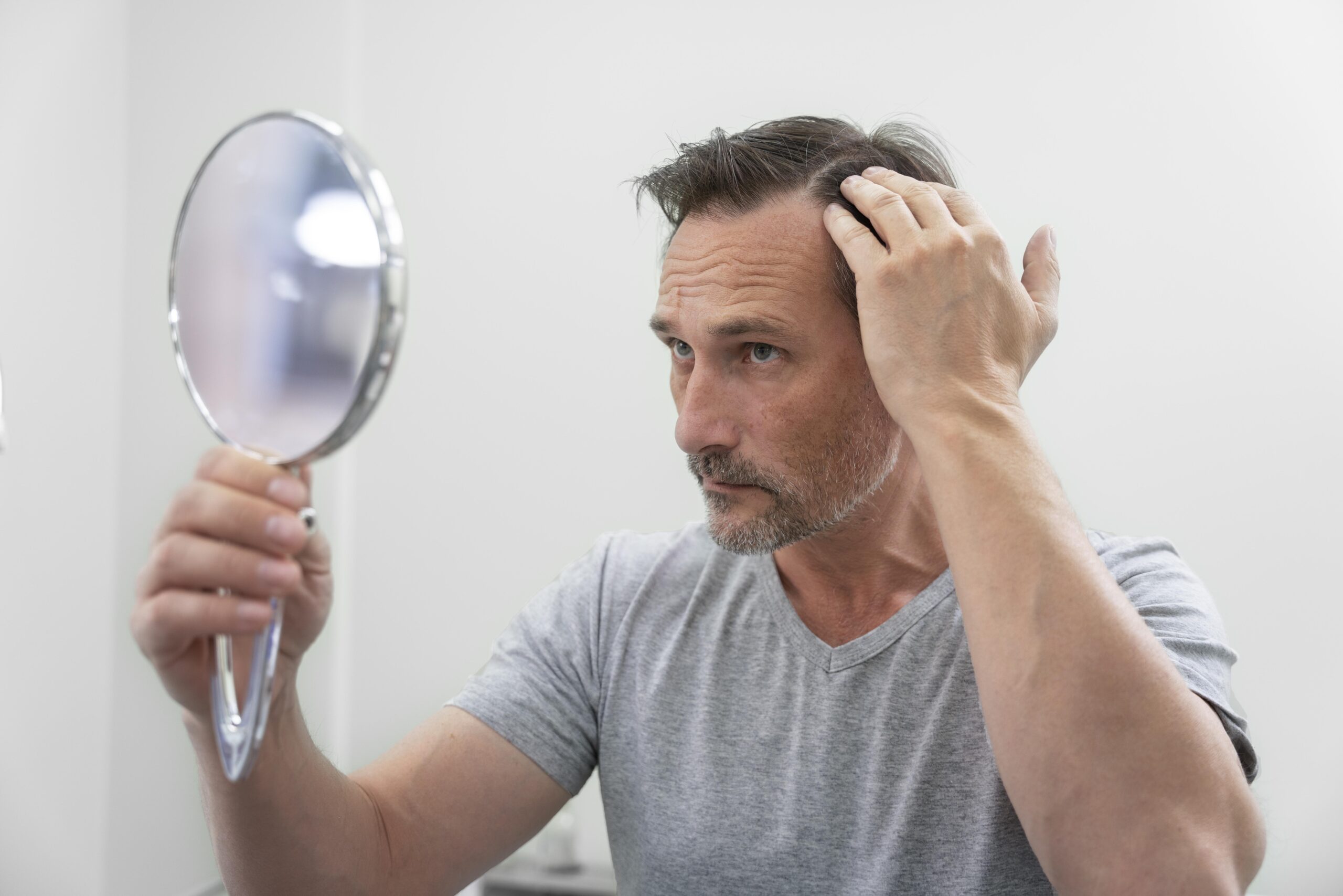 Receding Hairline? Here’s What You Can Do